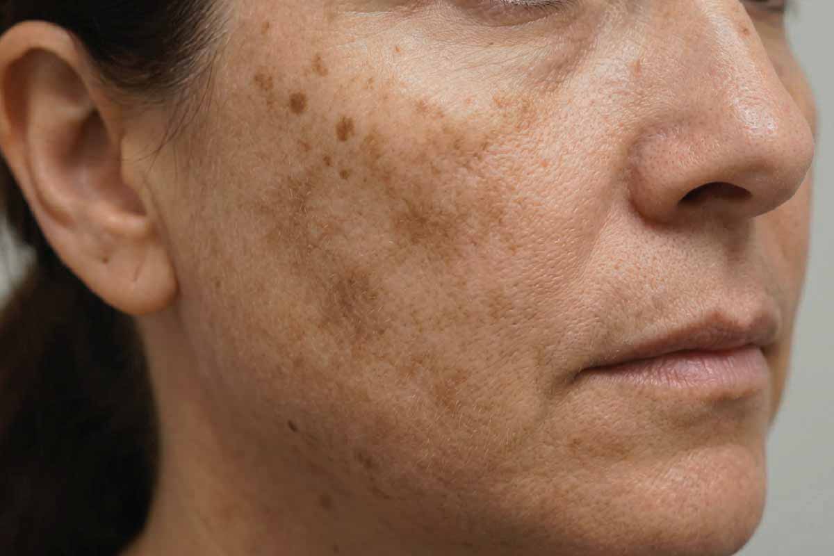 glutathione injection manchester Blog - CLNQ | Knutsford Cheshire